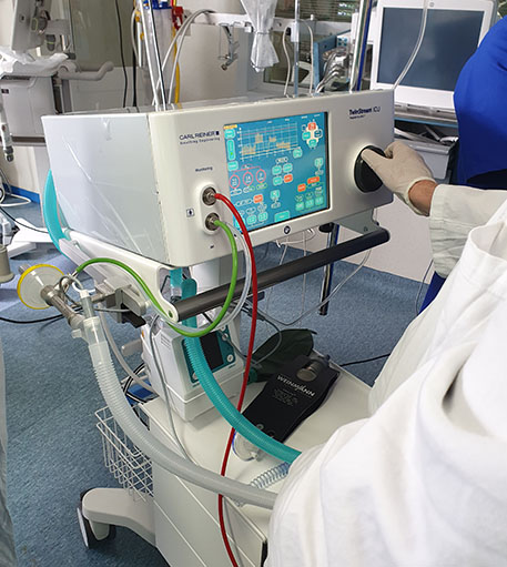 Critical care ventilator